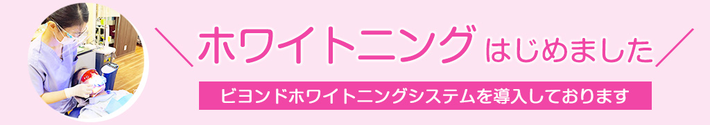 ホワイトニングはじめました